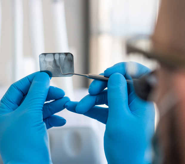 Marietta What is Endodontics?